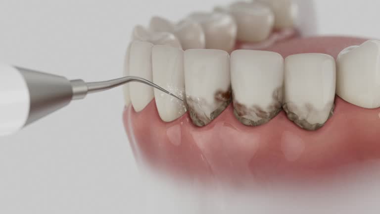 Reliable Dental contractor in Fountain County County, IN by Dentist Open Now